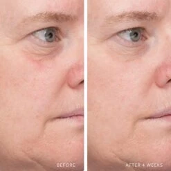 ULTRA HYDRATING SERUM WITH HYALURONIC COMPLEX-7 16 ULTRA HYDRATING SERUM WITH HYALURONIC COMPLEX-7 -Omorovicza Shop Lancer UltraHydratingSerumwithHyaluronicComplex 7 10