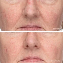 ULTRA HYDRATING SERUM WITH HYALURONIC COMPLEX-7 13 ULTRA HYDRATING SERUM WITH HYALURONIC COMPLEX-7 -Omorovicza Shop Lancer UltraHydratingSerumwithHyaluronicComplex 7 7