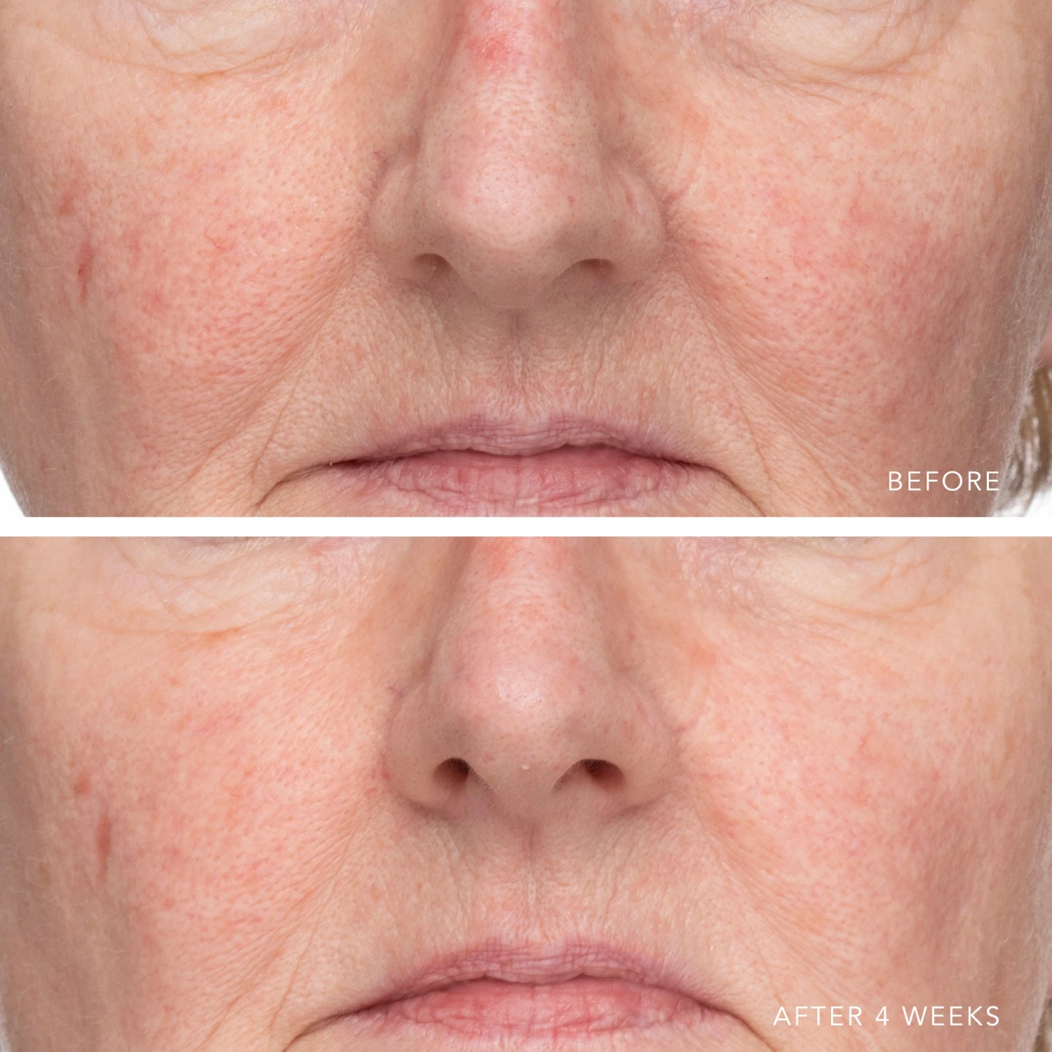 ULTRA HYDRATING SERUM WITH HYALURONIC COMPLEX-7 3 ULTRA HYDRATING SERUM WITH HYALURONIC COMPLEX-7 - Image 3