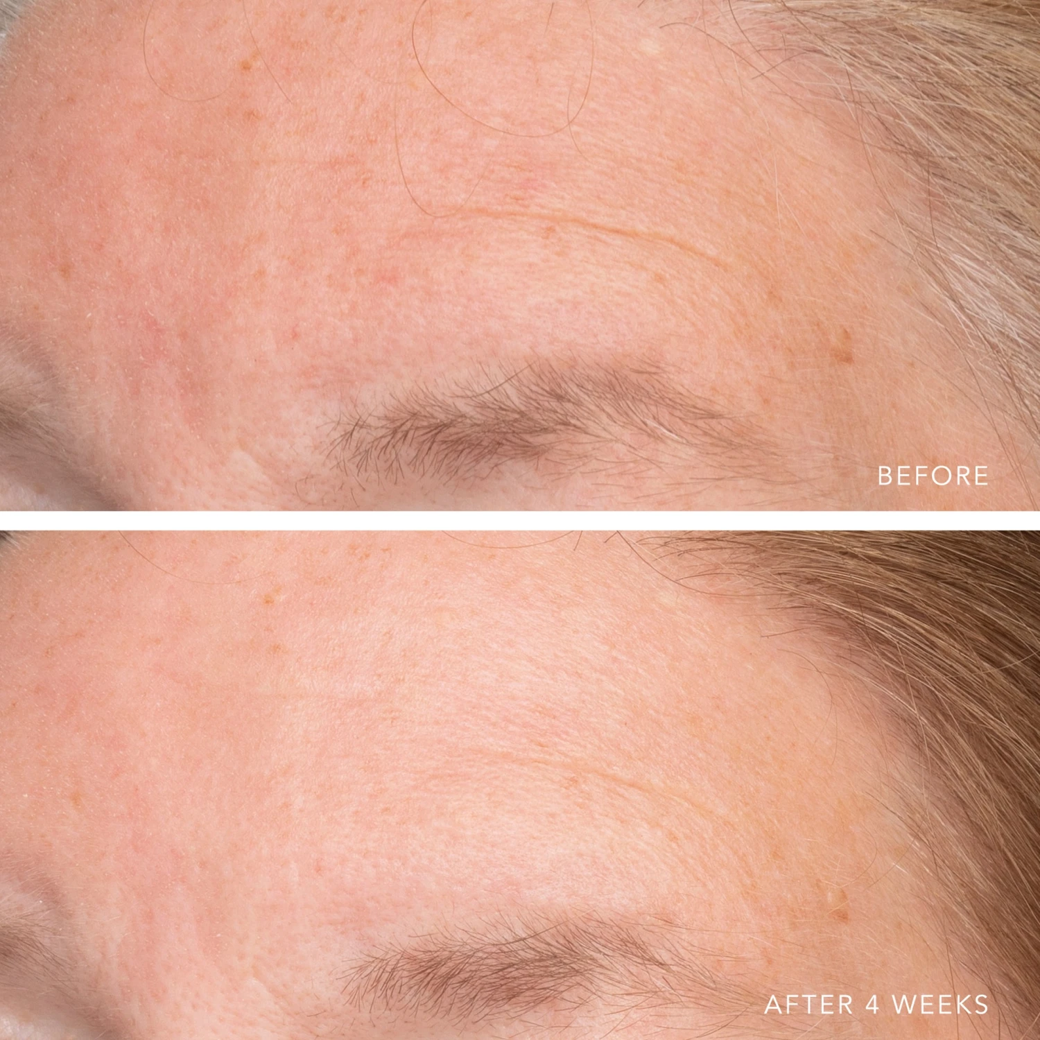 ULTRA HYDRATING SERUM WITH HYALURONIC COMPLEX-7 4 ULTRA HYDRATING SERUM WITH HYALURONIC COMPLEX-7 - Image 4