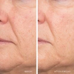 ULTRA HYDRATING SERUM WITH HYALURONIC COMPLEX-7 15 ULTRA HYDRATING SERUM WITH HYALURONIC COMPLEX-7 -Omorovicza Shop Lancer UltraHydratingSerumwithHyaluronicComplex 7 9