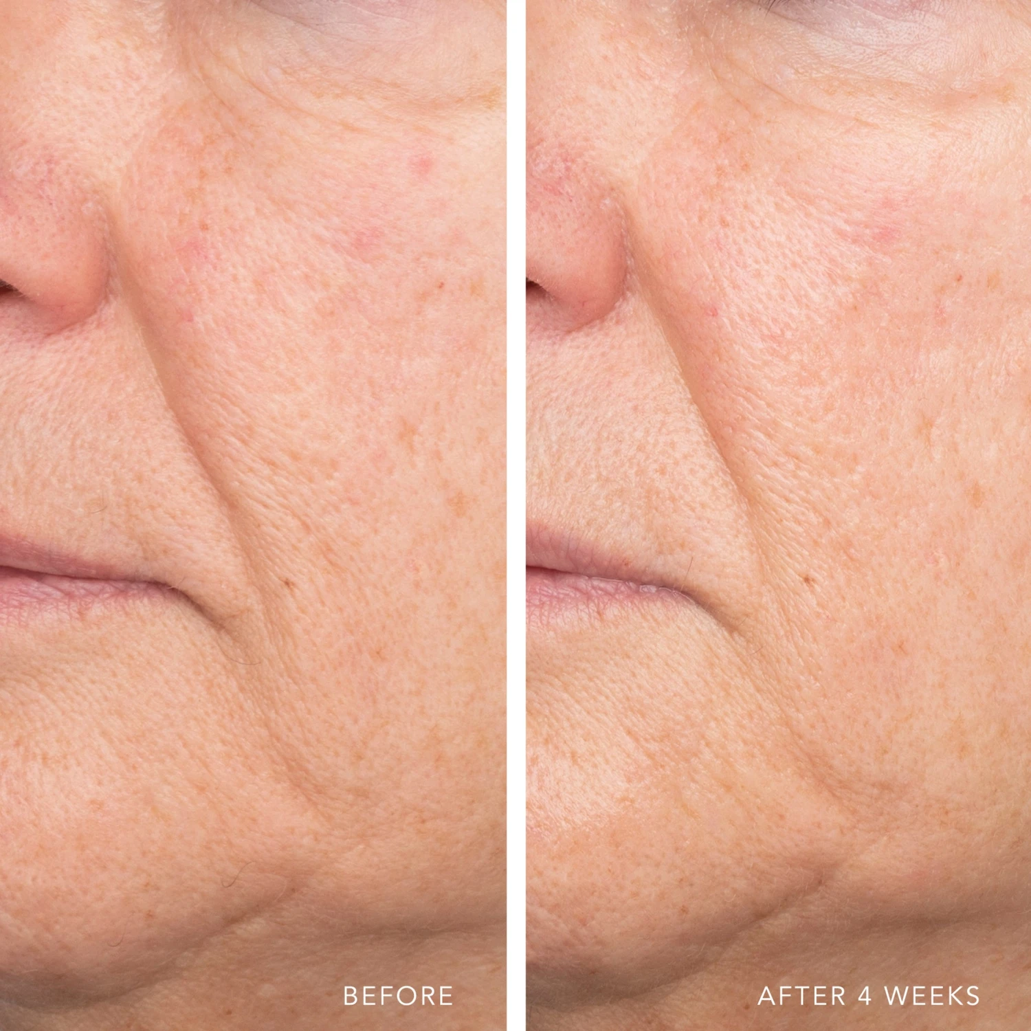 ULTRA HYDRATING SERUM WITH HYALURONIC COMPLEX-7 5 ULTRA HYDRATING SERUM WITH HYALURONIC COMPLEX-7 - Image 5