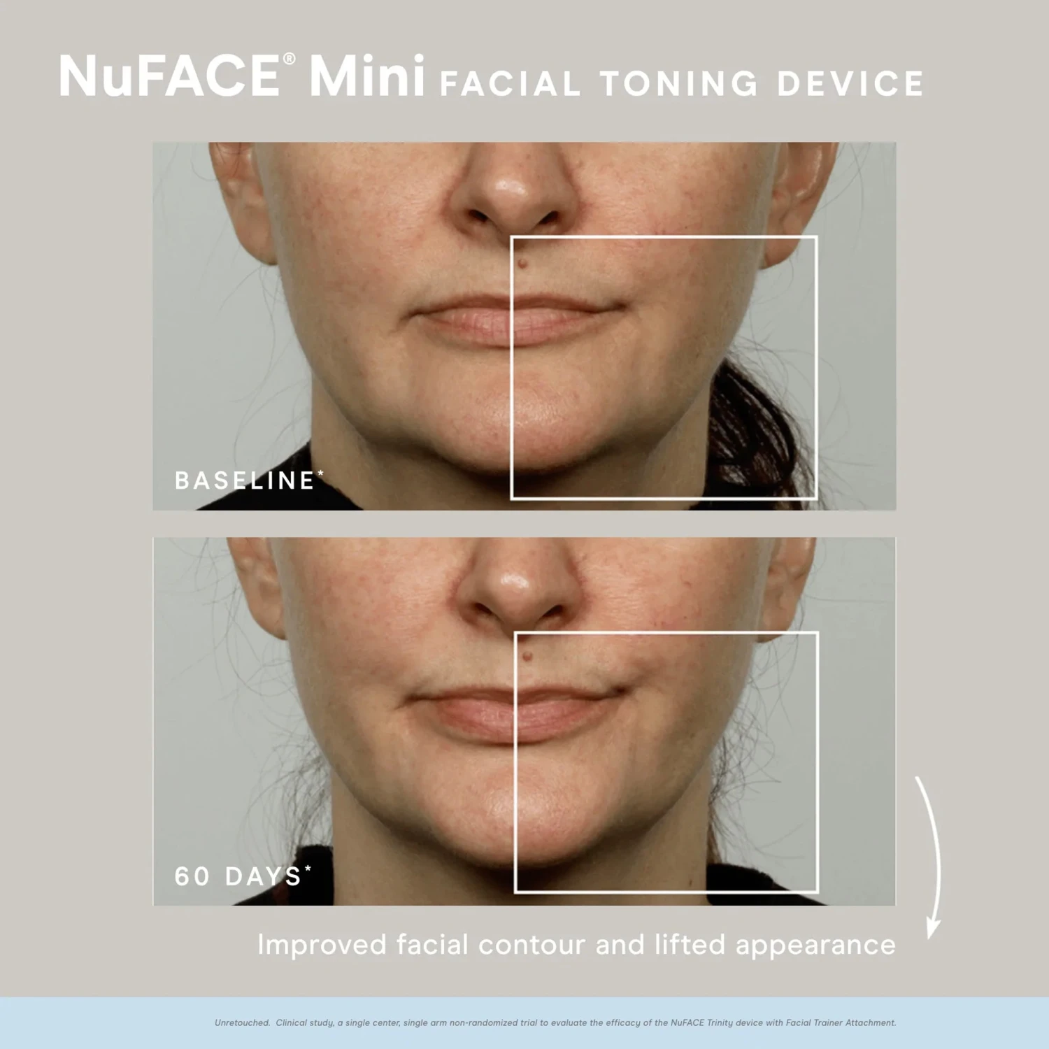 MINI FACIAL TONING DEVICE 3 MINI FACIAL TONING DEVICE - Image 3
