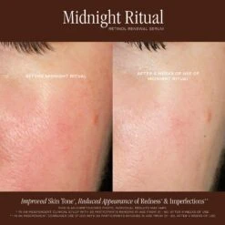 MIDNIGHT RETINOL SERUM -Omorovicza Shop SUMMERFRIDAYS MidnightRetinolSerum 7