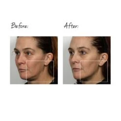 TRINITY FACIAL TONING DEVICE 15 TRINITY FACIAL TONING DEVICE -Omorovicza Shop nuface trinity facial toning device BA 1