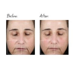 TRINITY FACIAL TONING DEVICE 17 TRINITY FACIAL TONING DEVICE -Omorovicza Shop nuface trinity facial toning device BA 2