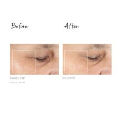 TRINITY FACIAL TONING DEVICE 16 TRINITY FACIAL TONING DEVICE -Omorovicza Shop nuface trinity facial toning device BA 3