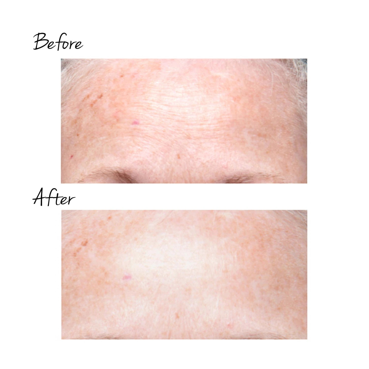 TRINITY WRINKLE REDUCER ATTACHMENT 3 TRINITY WRINKLE REDUCER ATTACHMENT - Image 3