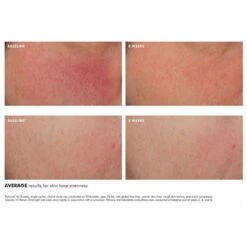 SkinCeuticals GLYCOLIC 10 RENEW OVERNIGHT 6 SkinCeuticals GLYCOLIC 10 RENEW OVERNIGHT -Omorovicza Shop skinceuticals Glycolic 10 Renew Overnight Exfoliating Treatment alt2