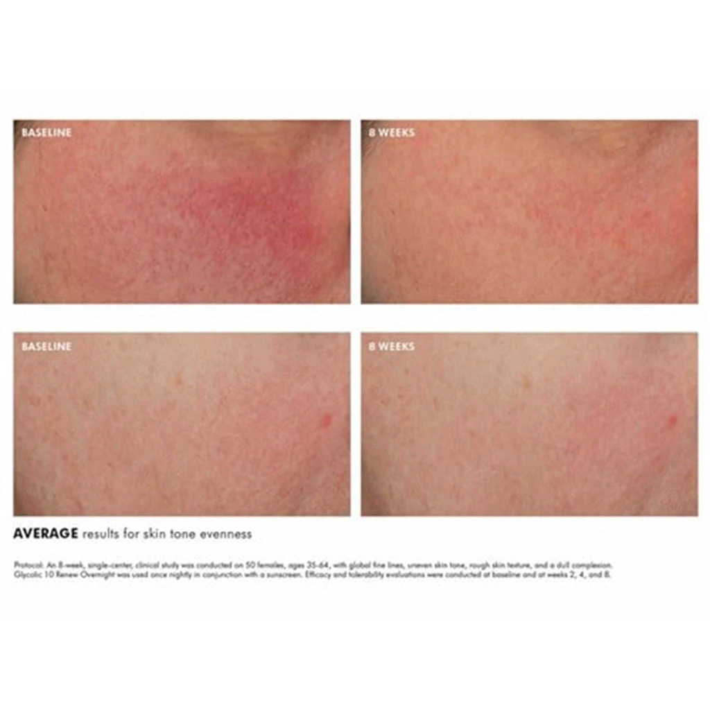 SkinCeuticals GLYCOLIC 10 RENEW OVERNIGHT 3 SkinCeuticals GLYCOLIC 10 RENEW OVERNIGHT - Image 3